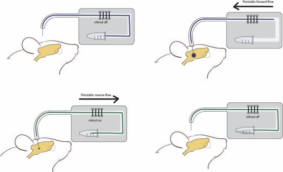 Our solution: a membrane-free micro-invasive probe (80μm diam) coupled to a novel nanofluidic peristaltic pump. The pump is actuated by nitinol wires & has a small dead volume (<30 nL) so it can extract smaller fluid volumes than other low-flow pumps (4/9)  http://tlo.mit.edu/technologies/nanofluidic-peristaltic-pump