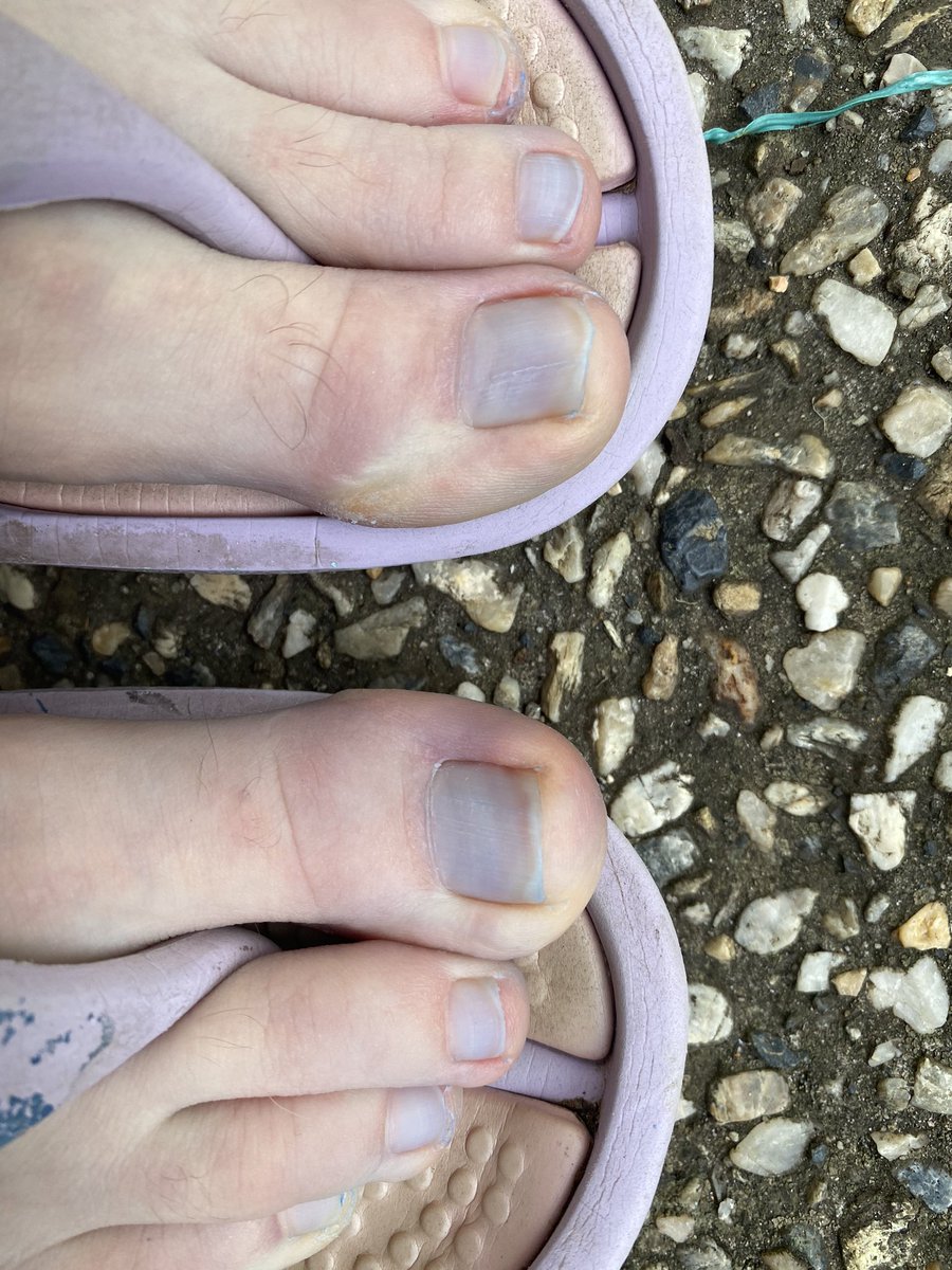 My toenails are... blue.