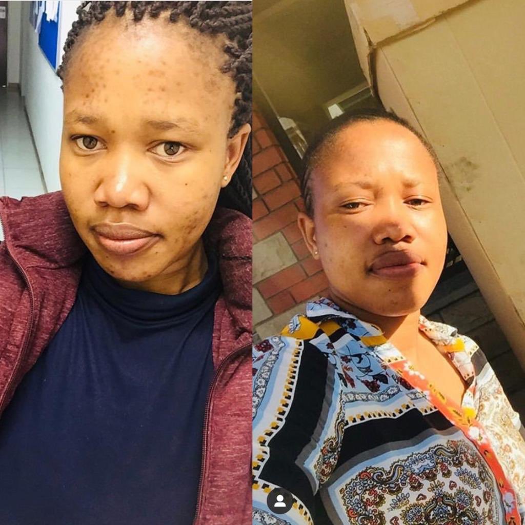 PortiaM_Skin's tweet photo. Be Patient With Your S K I N And Consistent With The Products For A Graceful Glow....🍒🍃
#BeforeAndAfter
#PMSquad
#DiversityDefinesAfrica
#HappyHeritageMonth
#IAmAnAfricanThereforeAfricaLivesInMe https://t.co/r2XkYV6VPT