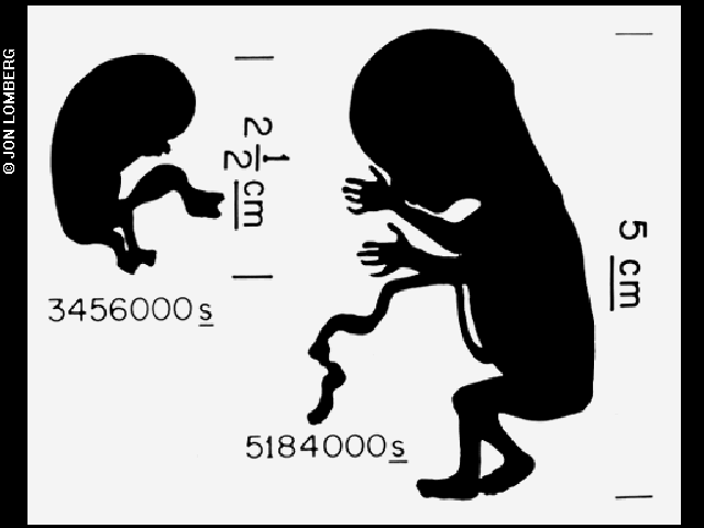 12/1. Fetus diagram2. Male and female diagram3. Nursing mother4. Diagram of family agesSee more diagrams here:  https://voyager.jpl.nasa.gov/golden-record/whats-on-the-record/images/