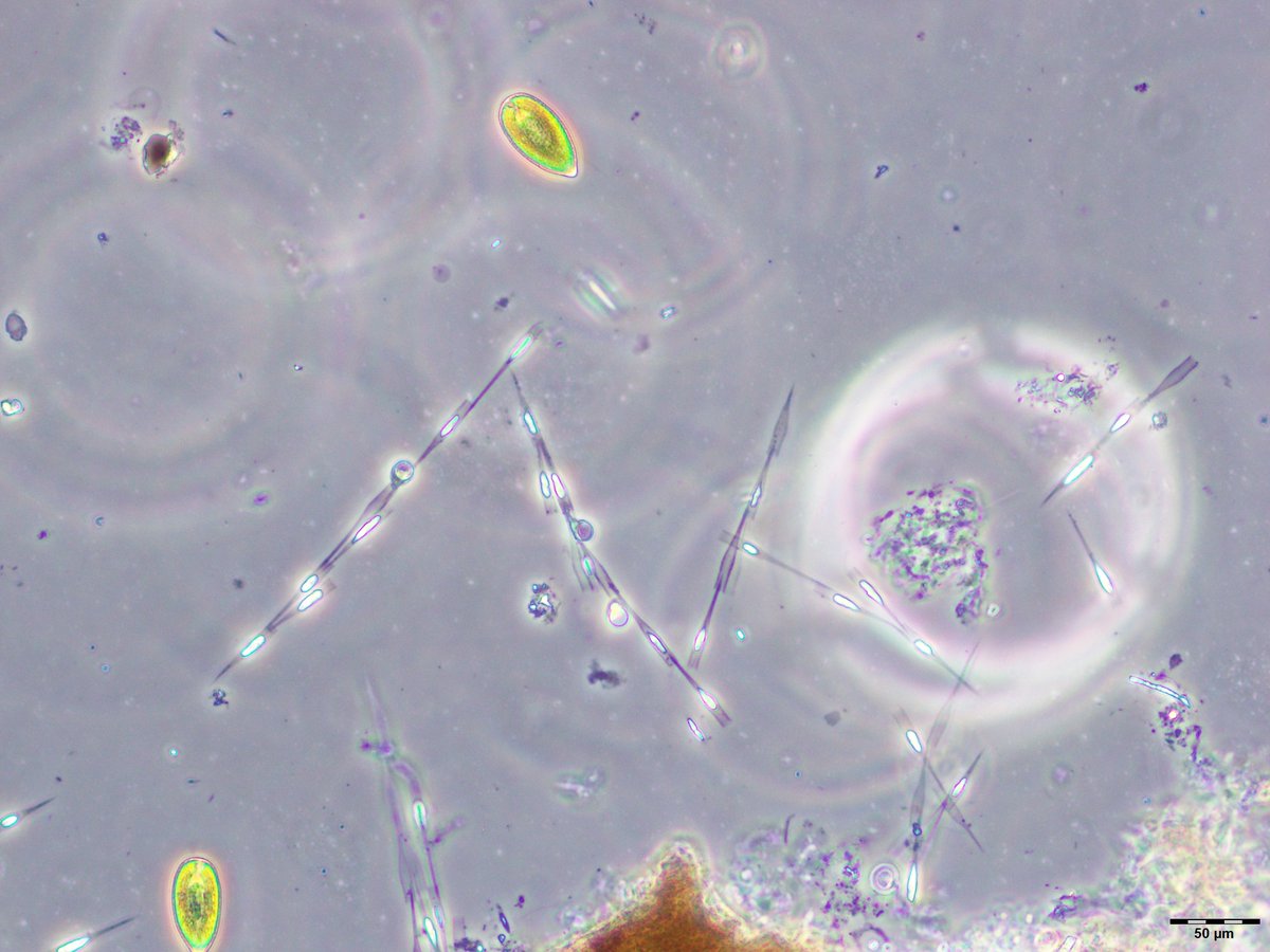 FBL_UCPH's tweet image. Most of the #phytoplankton samples that Trine processes in the microscope lab are fixed with Lugol and are kind of drab to look at. So this live sample from #dystrophic lake #Gribsø containing #desmids, #chrysophytes and #raphidophytes was a real treat!