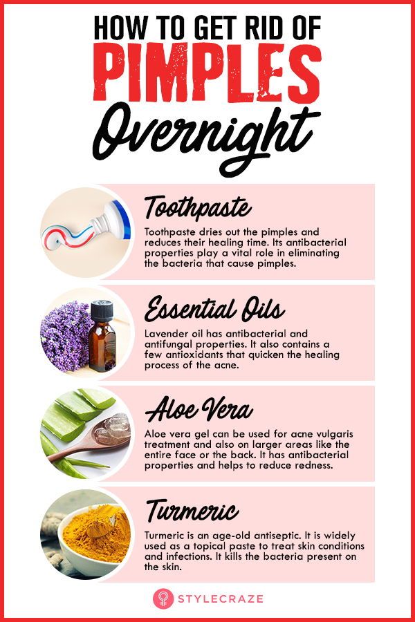 HealthA28860915's tweet photo. 22 Home Remedies for Acne & Pesky Pimples
Your skin is your friend. You like your skin. Your skin likes you. It protects you from the elements and literally keeps you together. You in turn do your best to protect it from any kind of damage. Then, one day, acne rears its #pimpal https://t.co/TIe7t7AcED