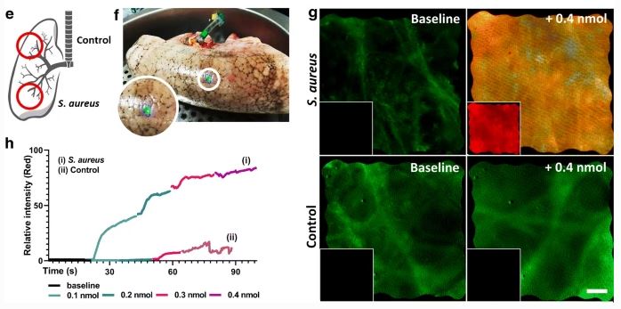 Beth Mills (@mills6b) on Twitter photo Read our latest publication "Molecular detection of Gram-positive bacteria in the human lung through an optical fiber–based endoscope" in #EJNMMI here: edin.ac/3iFmZxm
A true collaborative <a href="/EPSRC_Proteus/">EPSRC Proteus IRC</a> effort from @EdinUni_MeetCIR <a href="/EdinburghChem/">Chemistry Edinburgh</a> <a href="/UniofBath/">University of Bath</a> & more Read our latest publication "Molecular detection of Gram-positive bacteria in the human lung through an optical fiber–based endoscope" in #EJNMMI here: edin.ac/3iFmZxm
A true collaborative <a href="/EPSRC_Proteus/">EPSRC Proteus IRC</a> effort from @EdinUni_MeetCIR <a href="/EdinburghChem/">Chemistry Edinburgh</a> <a href="/UniofBath/">University of Bath</a> & more