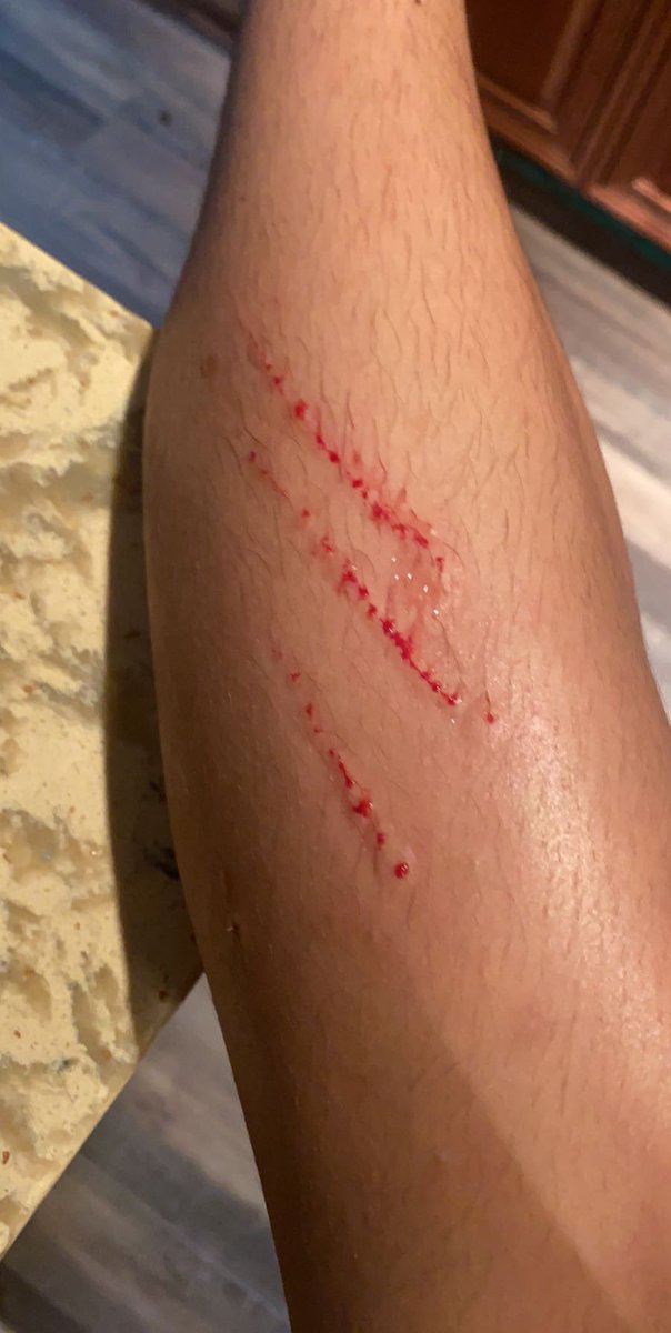 ilybabyjoy's tweet image. THE CLAWS