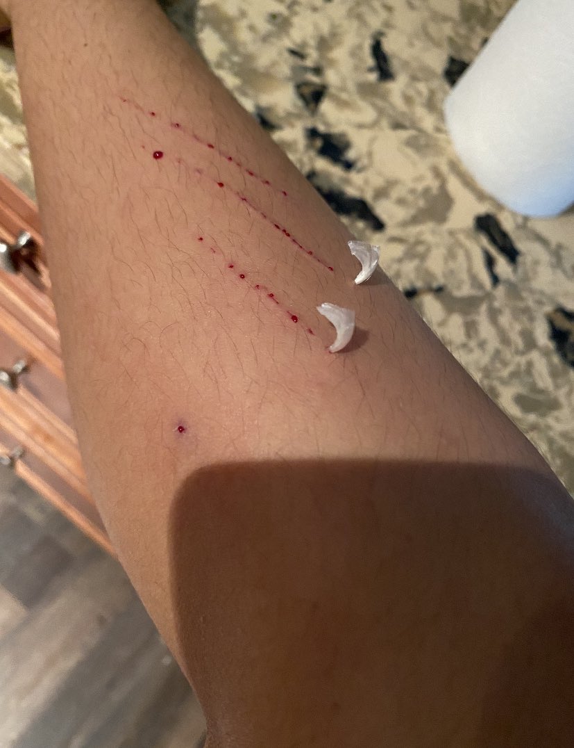 ilybabyjoy's tweet image. THE CLAWS