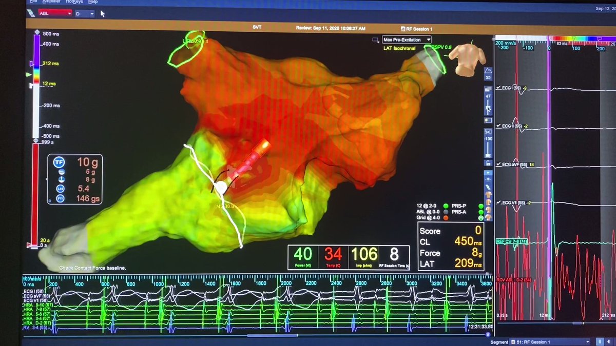 MapsForDays's tweet photo. Wolf hunting, open windows style.  @AbbottCardio.  #HDgrid https://t.co/VlV7sZJ2cB