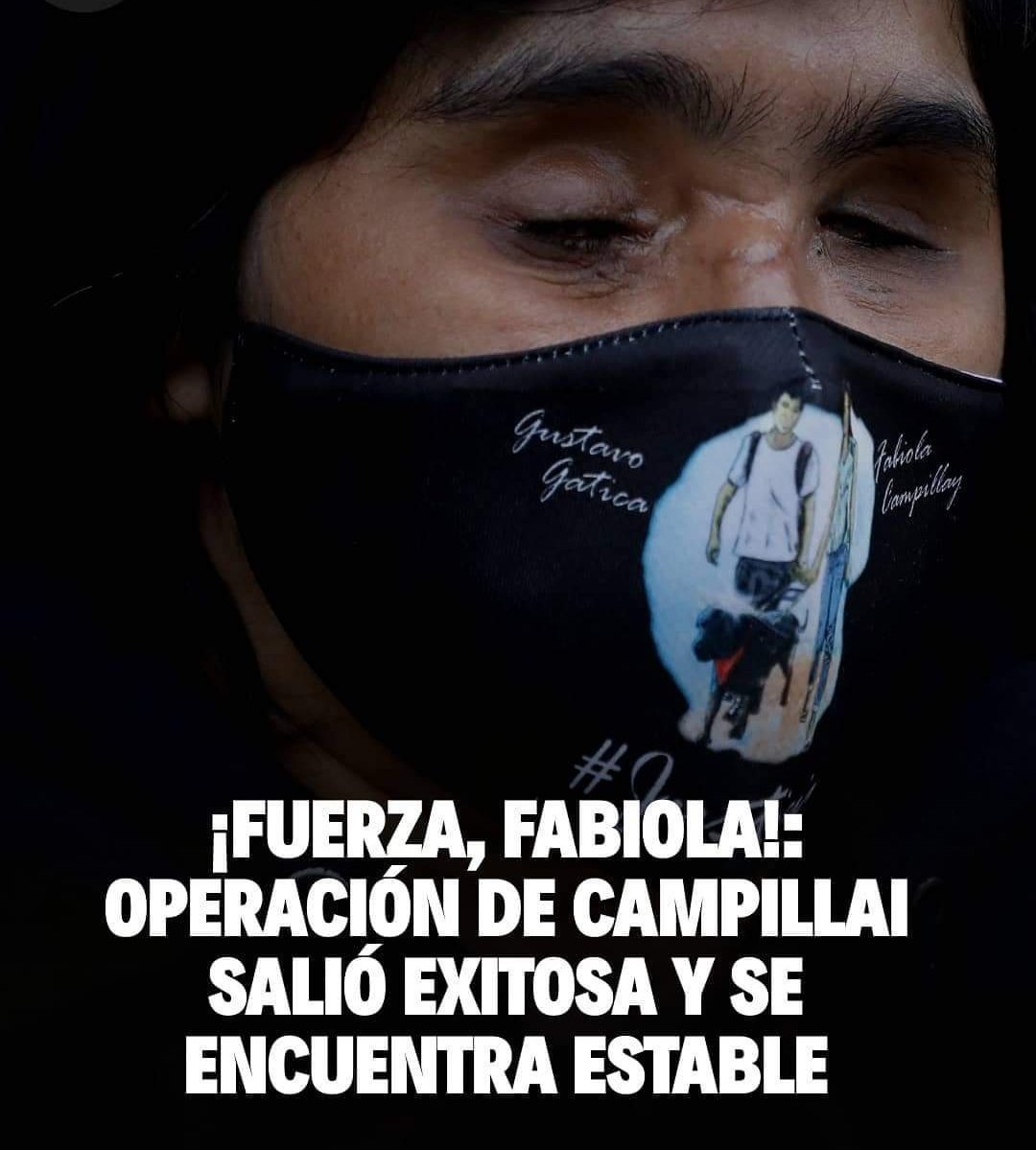 pchile_web's tweet photo. 🔴 Tras una delicada operación, el Instituto de Seguridad del Trabajo (IST) confirmó que la intervención quirúrgica a Fabiola Campillai resultó exitosa y ahora ella se encuentra con "relativa estabilidad".

@chileconvoca https://t.co/ywl0E7PzgG