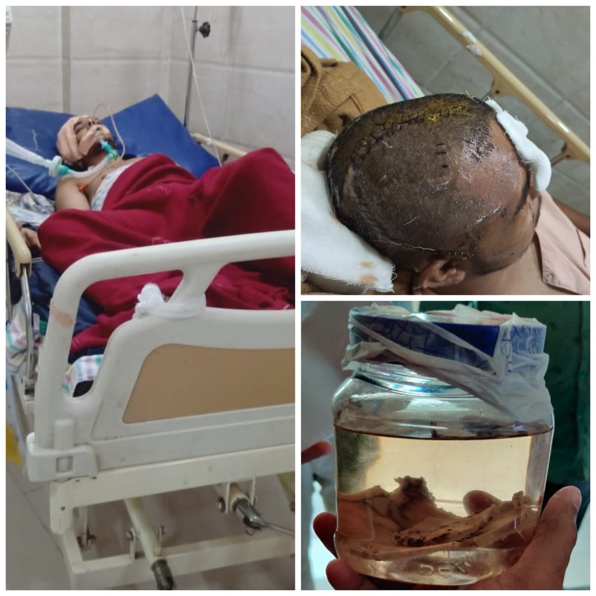 DivyasinghRS's tweet photo. Namaskaram @SonuSood ji
Every Life Matters : Please help Lalit  &amp; give him a new life. Sir Please retweet it &amp; ask everyone to retweet &amp; share it as much as possible so that family of Lalit get the best possible Donation for treatment. https://t.co/H7IdQWtbis