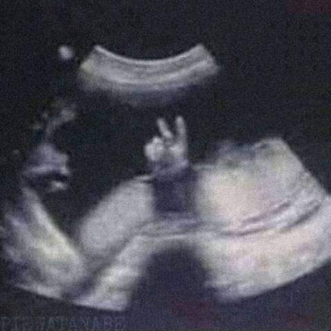 ✌