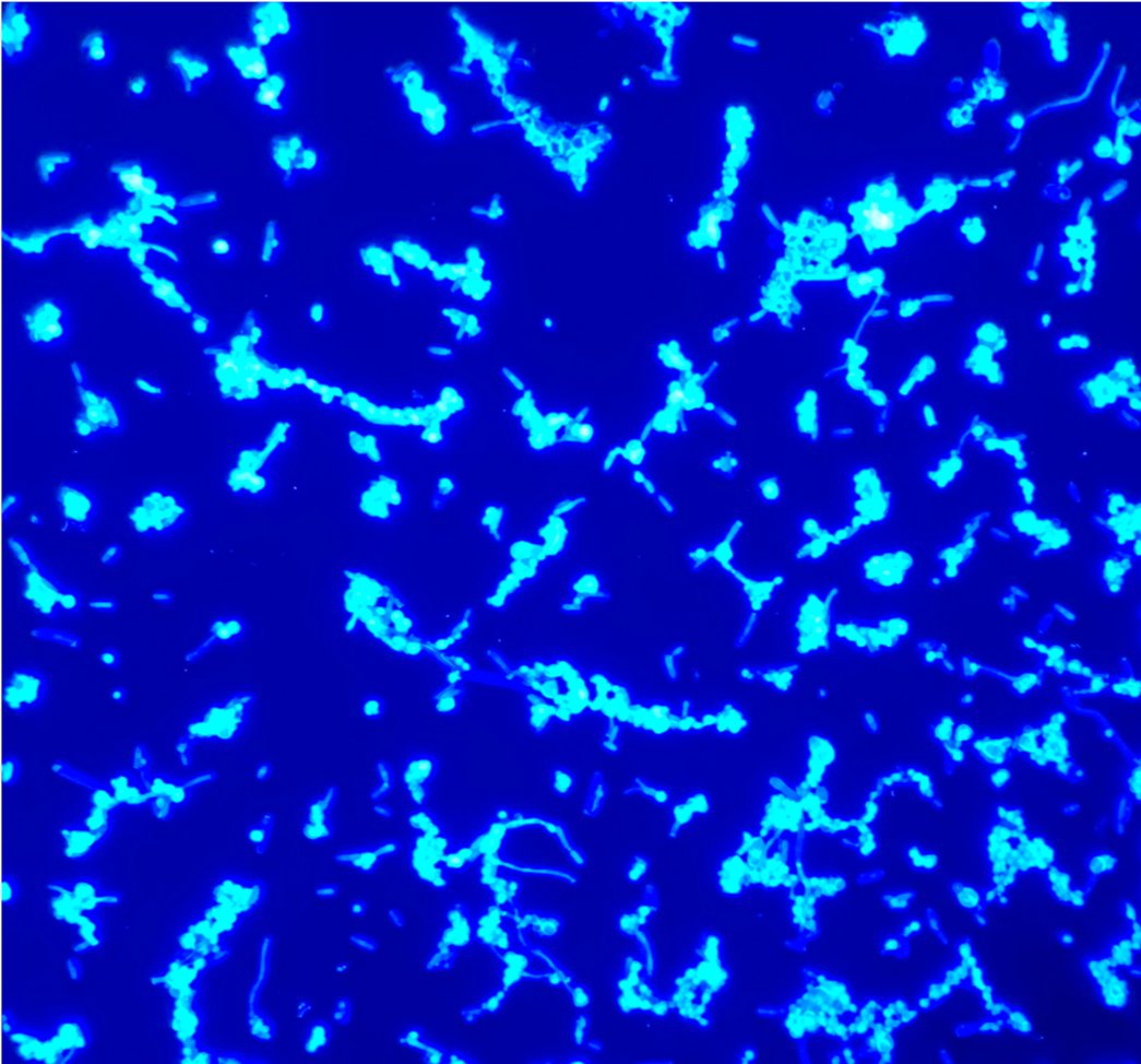 💡Autofluorescence💡is described in some species of bacteria & yeast Fun fact ✅ Mycobacteria emit autofluorescence in the cyan range of the visible spectrum (pictured) #IDTwitter #IDMedEd #MicroRounds @AkamineMD ncbi.nlm.nih.gov/pmc/articles/P…
