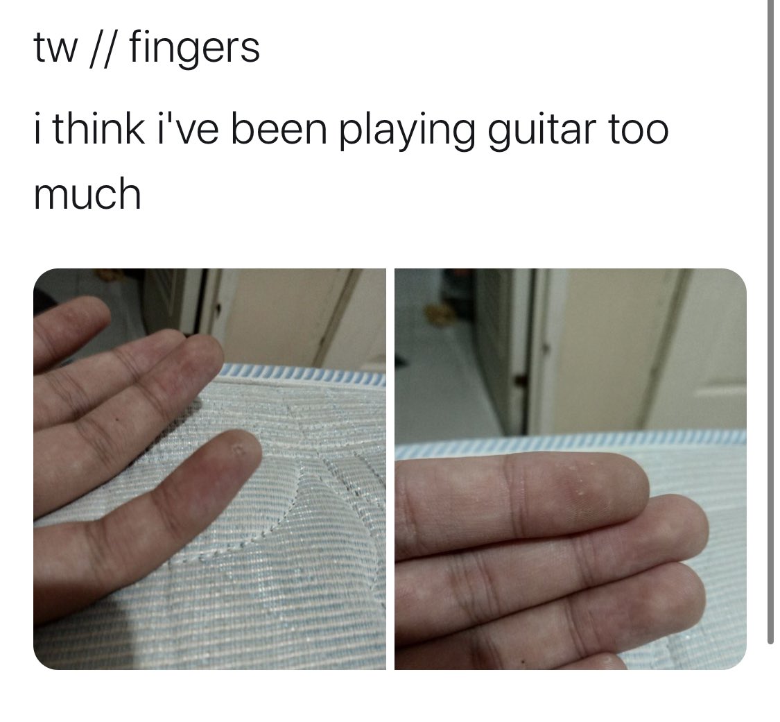 trigger warning of the day is FINGERS