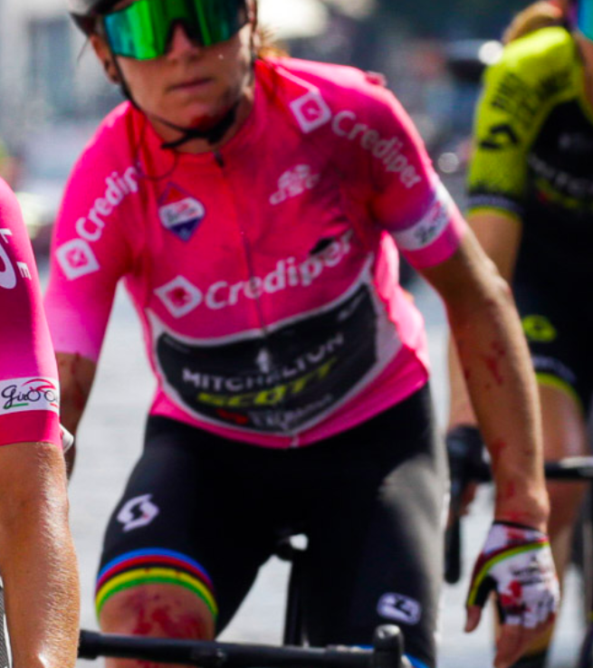 Size of Annemiek van Vleuten's wrist on the finish line of today's #GiroRosa - apparently fractured.

Fair play for finishing, even if perhaps we're not supposed to praise those endeavours of bravery in the light of serious injury these days.

Hard as nails.