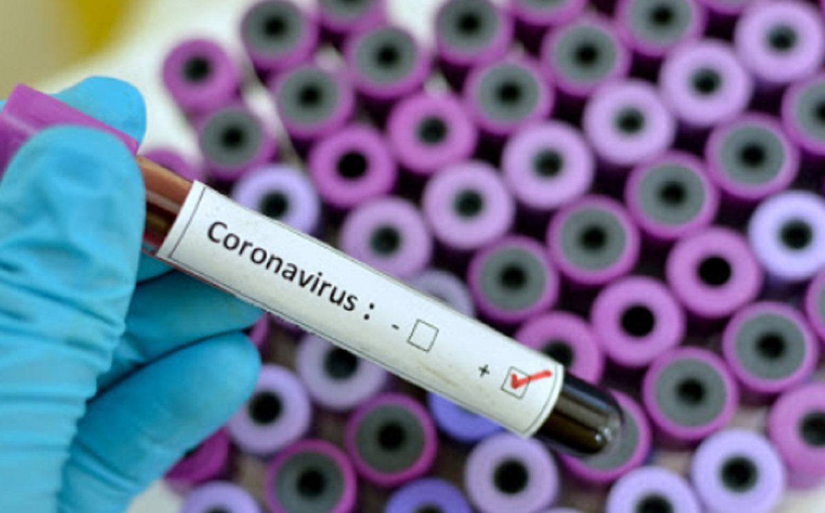 Test Covid, in 12 minuti rileva sia gli anticorpi che il virus is.gd/Yv0AnB #Coronavirus #Scienze