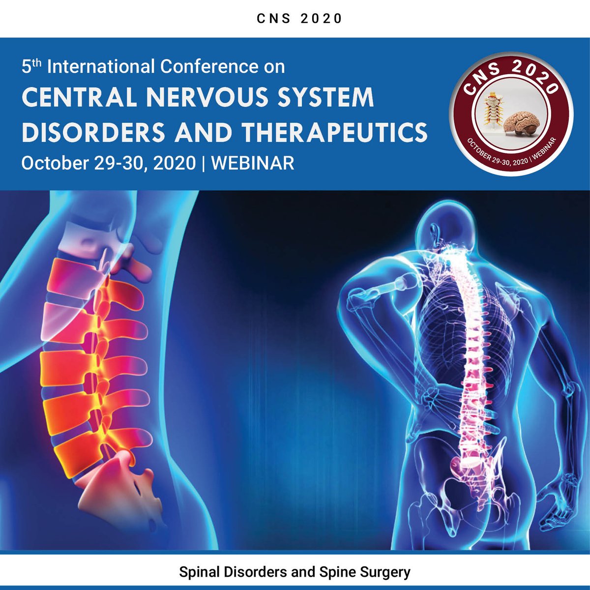 #Spinedisorders have a wide variety of causes depending on the particular condition. Common #causes include:
Accidents or fall #Congenitaldisorders; #InflammationInfection #Inheriteddisorders Injuries ranging from minor to #traumatic #Degenerative wear and tear