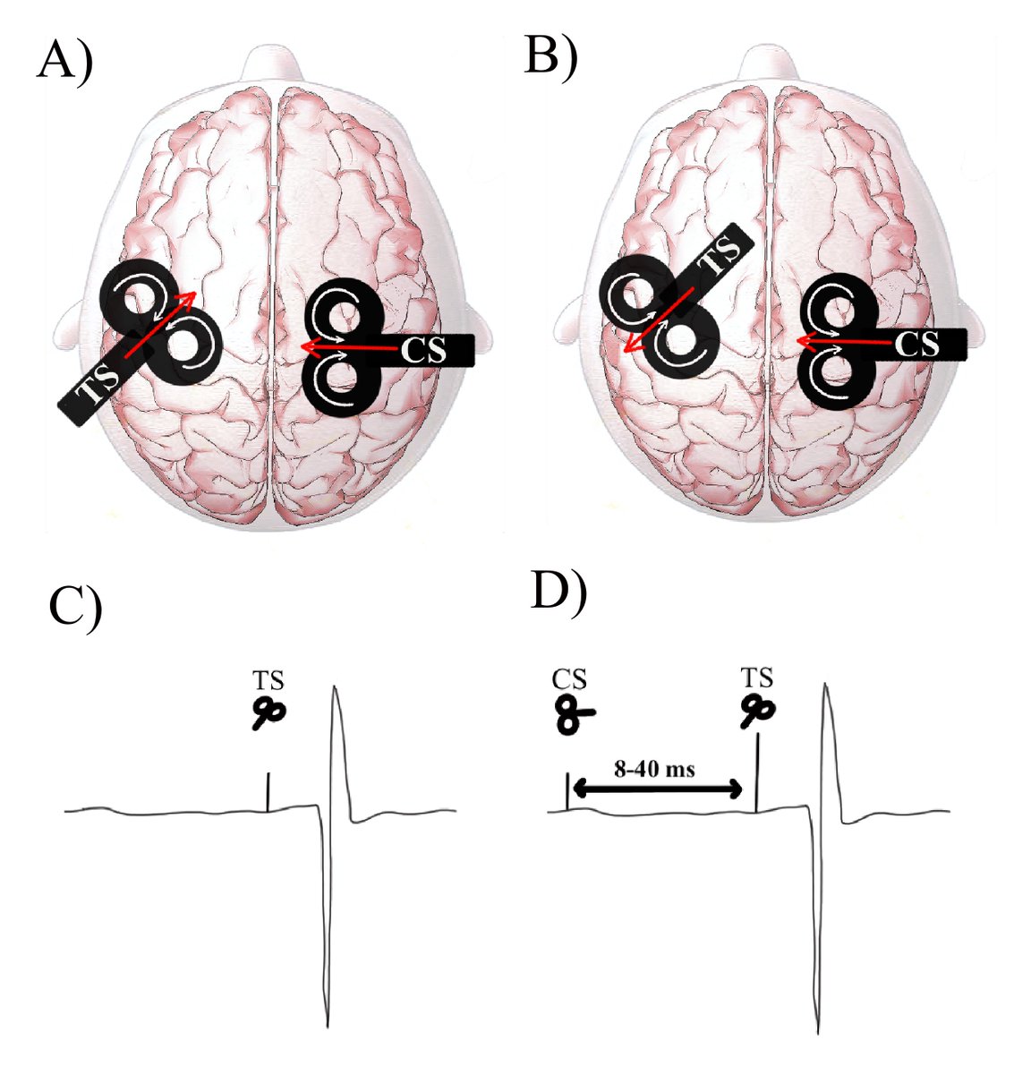 ClinicalNeuroph's tweet image. [TMS in press] Calvert et al. characterized the effect of altering TMS parameters on the magnitude of interhemispheric inhibition from the dorsal premotor to the primary motor cortex.

doi.org/10.1016/j.clin…
@tcddublin
#ClinicalNeuroph #TMS #Inhibition #M1