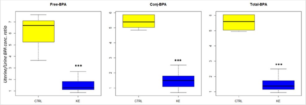 #EndometrialCarcinoma and #Bisphenol A: A Pilot Case-Control Study by Laura Sarno* in #BJSTR 
biomedres.us/fulltexts/BJST…
Follow on blogger :: biomedres01.blogspot.com
Like our pins on :: pinterest.com/biomedres/