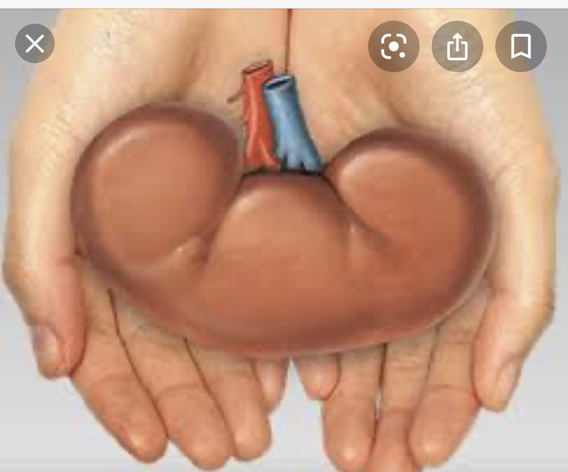 1/ FYI <a href="/edmnangagwa/">President of Zimbabwe</a> <a href="/nickmangwana/">Nick Mangwana</a> <a href="/MoHCCZim/">Ministry of HealthZW</a> I have just learnt with great sadness from a Senior Nephrologist that 21 renal failure patients on dialysis died in August 2020 alone. This is the accounted-for number ; much more even died in both the public sector &amp; Pvt sector.