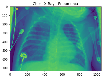 Websystemer's tweet image. The importance of domain knowledge - websystemer.no/the-importance…

 #datascience #deeplearning #domainknowledge #imageclassification #machinelearning