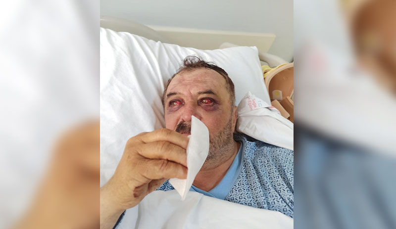 artigercek's tweet photo. Gözaltına alınan köylülere işkence yapılmış
https://t.co/qBpxjFN6aS https://t.co/ScQ9OITk0n