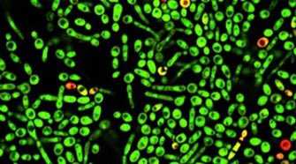HMHNBandara's tweet image. I have a place available for a self-funded #PhD in my lab. If anyone is interested in #polymicrobial #biofilms #microbial communication and/or #AMR and have a scholarship or financial support, please get in touch.
Please #retweet this. @AcademicChatter 
@PhDchatter @BristolUni