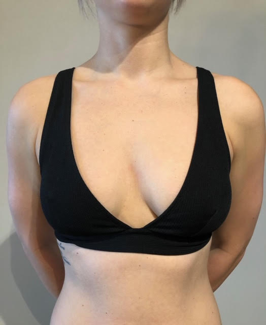 BednarCosmetic's tweet photo. Considering Fat Transfer to the breasts? Patients travel from all over the world for Dr. Bednar's natural results. Email info@drbednar.com to schedule a free consultation. #fattransfer   #breastaugmentation https://t.co/yRbTJaSuac