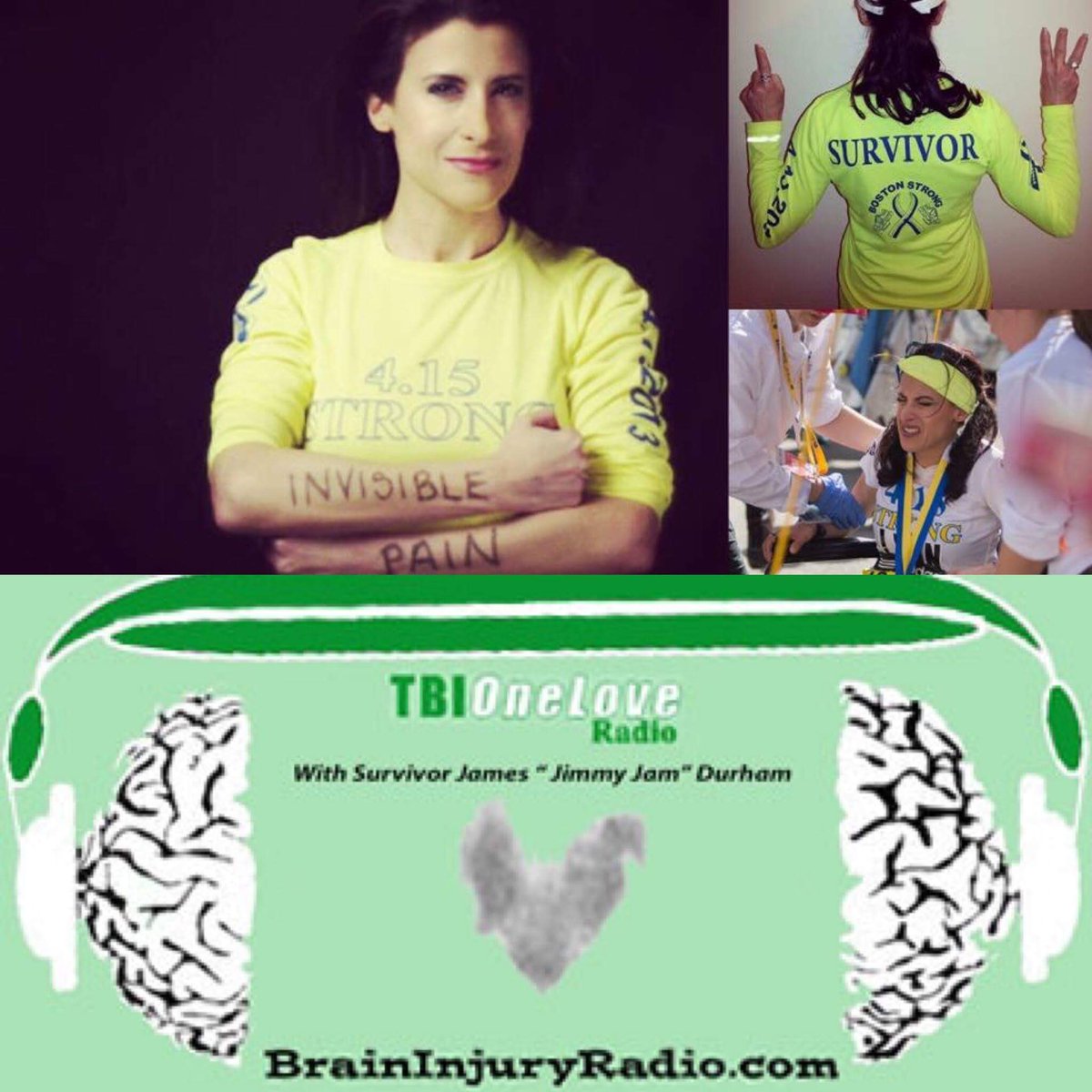 lynnjulian007's tweet image. #ConcussionAwarenessDay
5 Concussion Facts:

🧠 Concussion IS a TBI
Traumatic Brain Injury

🧠 “Mild” concussions
need treatments

🧠 You do NOT 
have to hit your head
 
🧠 You do NOT 
have to pass out

🧠 whiplash or blast force trauma
= #concussion
 
#Lynnjulian #TBI #TBIgirl