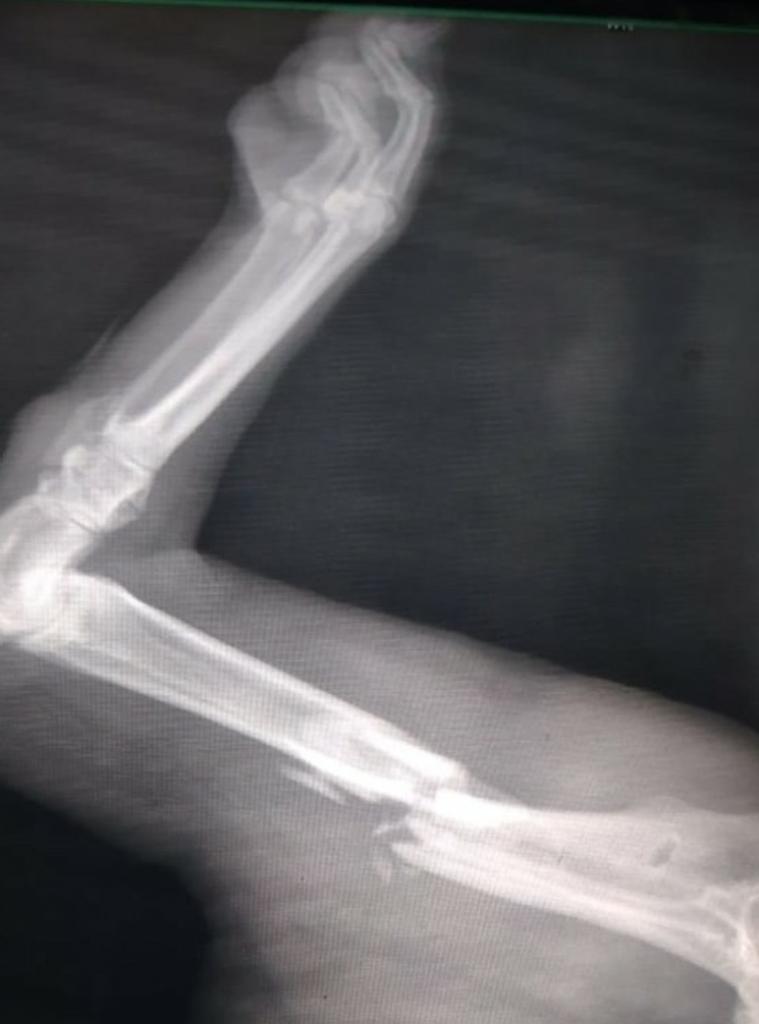 Darvinson Rojas Sánchez tweet media