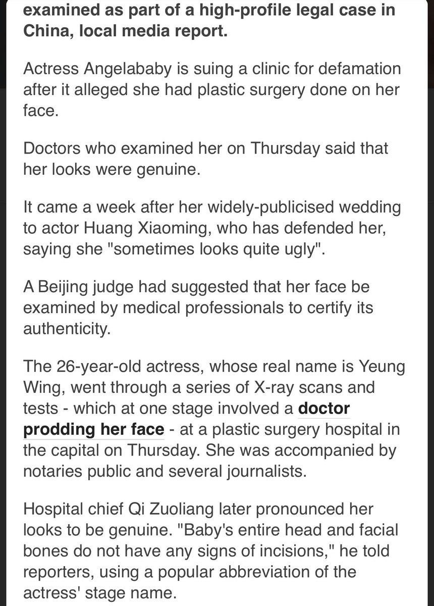 imagine being so pretty that there’s a whole court case about whether you had plastic surgery