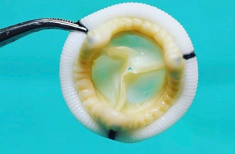 Bunun ne olduğunu soracağım ve 2 tip insan çıkacak karşımıza..