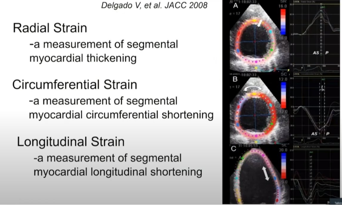 tanushreeMD's tweet photo. When and how to use strain imaging: Excellent talk by Dr. Quinones. @maquinonesmd #MMI2020 #Cardiotwitter #ACCFIT #MedEd #ACCImaging #CVImaging #EchoFirst 
Tune in and watch live: https://t.co/pYQYvdWSpQ https://t.co/V2X3JzvWqz