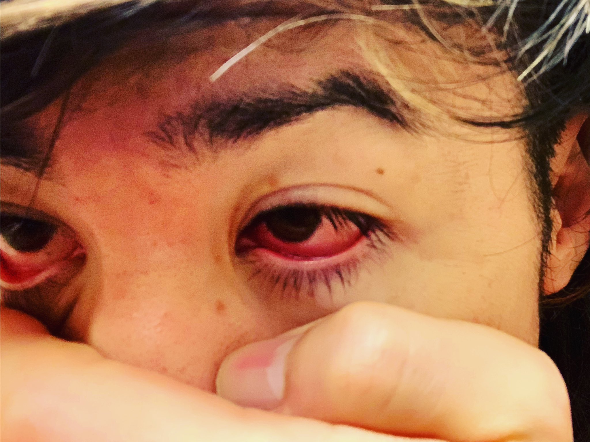 虹キラ隊長 A K A Nijikila 大麻とかやってないんだけどさ 朝起きたら目がコレ 痛くて3秒と開けてられない あー 終わりや しばらくスロ出来ねぇかなこれ いや マジで大麻はやってない 本日 良番ぜんぶ蹴ります オマエら いいパチ屋