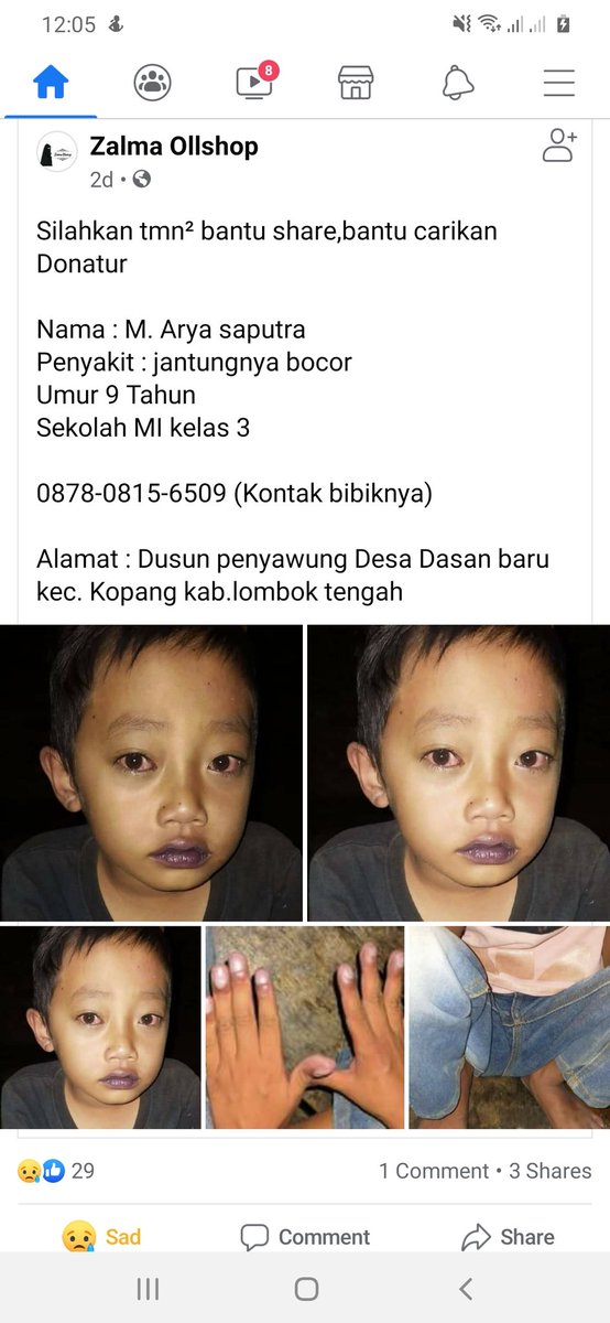 erna_st's tweet photo. Bantu up tweeps, mohon tag instansi dan pejabat terkait ya🙏

Nama : M. Arya saputra (9 tahun),
Sakit : jantung bocor, 
Sekolah MI kelas 3 

0878-0815-6509 (Kontak bibiknya)

Alamat : Dusun penyawung Desa Dasan baru Kec. Kopang kab. Lombok tengah https://t.co/wldY2aLpGK