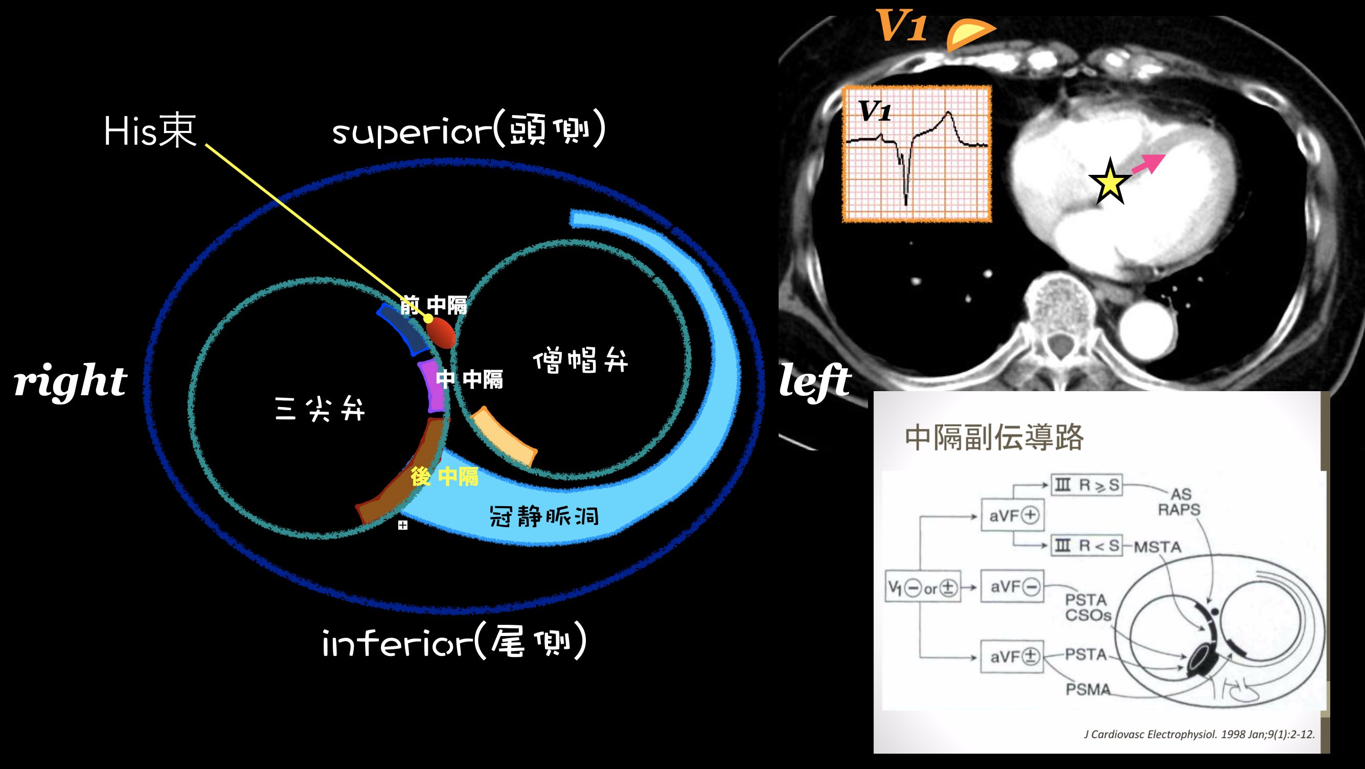 N. Tsukishima EP大学心電図検定学部試験対策科担任 on X