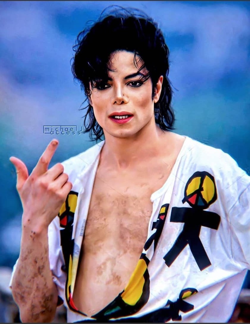 Michael Jackson Vitiligo Lupus