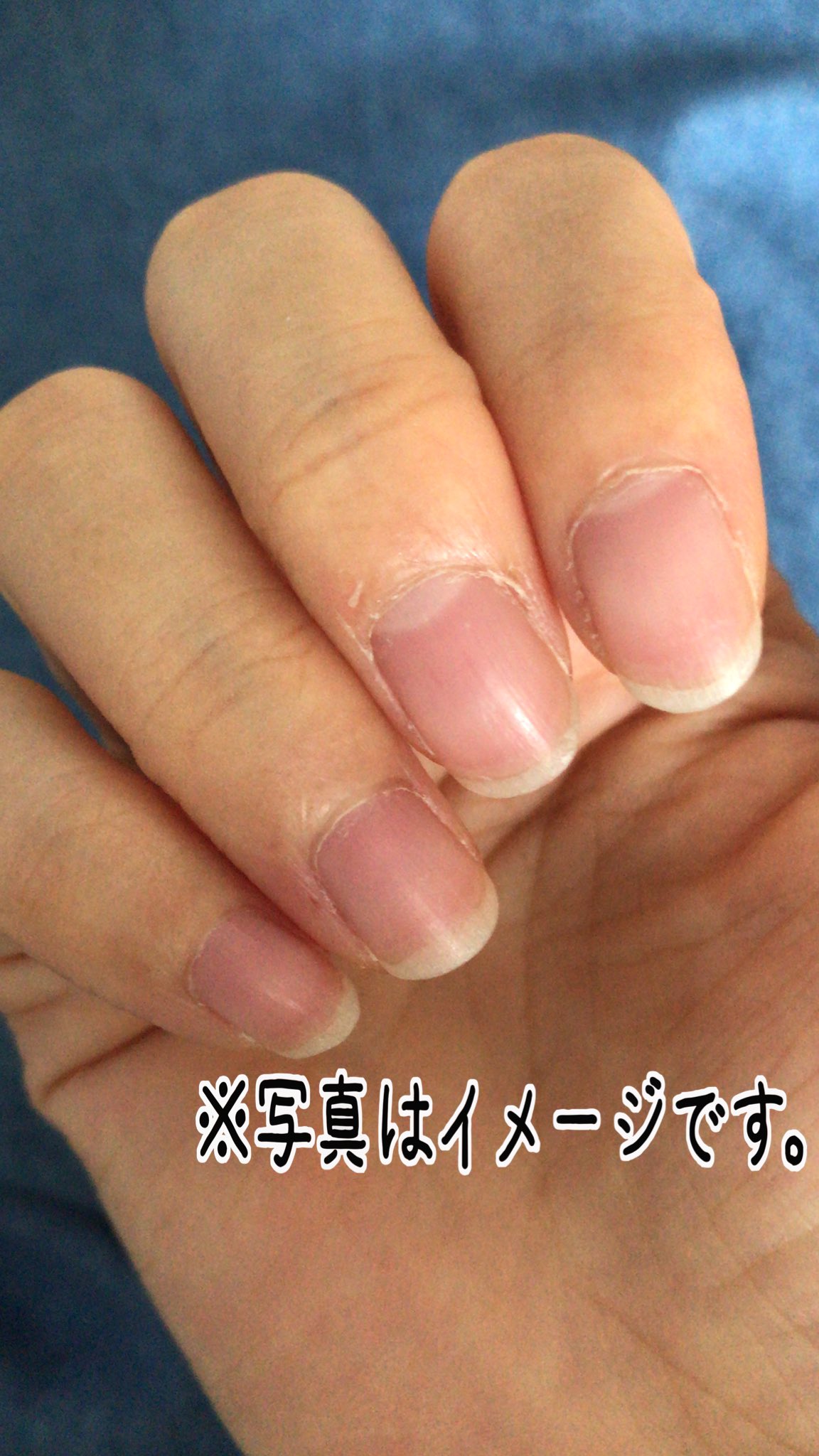 キイ Twitterren 最近爪が痛い ジェルネイルしてから 爪が弱い 汚い 保湿が大事と言われたような ハンドクリームする習慣付けしないと ささくれもちょいあるし T Co 0n1iwi7iks Twitter