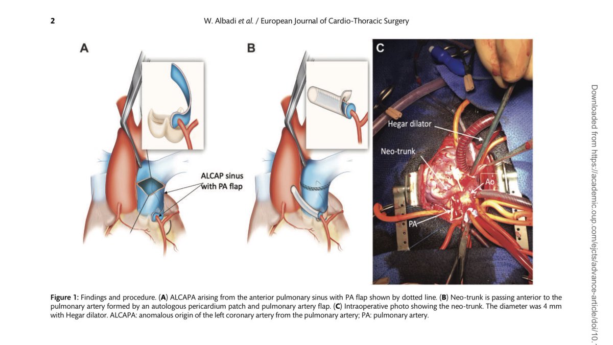 قمتُ بنشر طريقه جراحية جديدة ومبتكرة تُنشر لأول مرة في المجلة الاوروبية لجراحة القلب والصدر العريقة "EJCTS" لعلاج عيب خلقي نادر جداً في الشريان التاجيّ الايسر لقلب الأطفال وتعتبر من أصعب العمليات لدقتها وندرتها
.
. 
.
#إنجازات_شباب_عمان
 doi.org/10.1093/ejcts/…