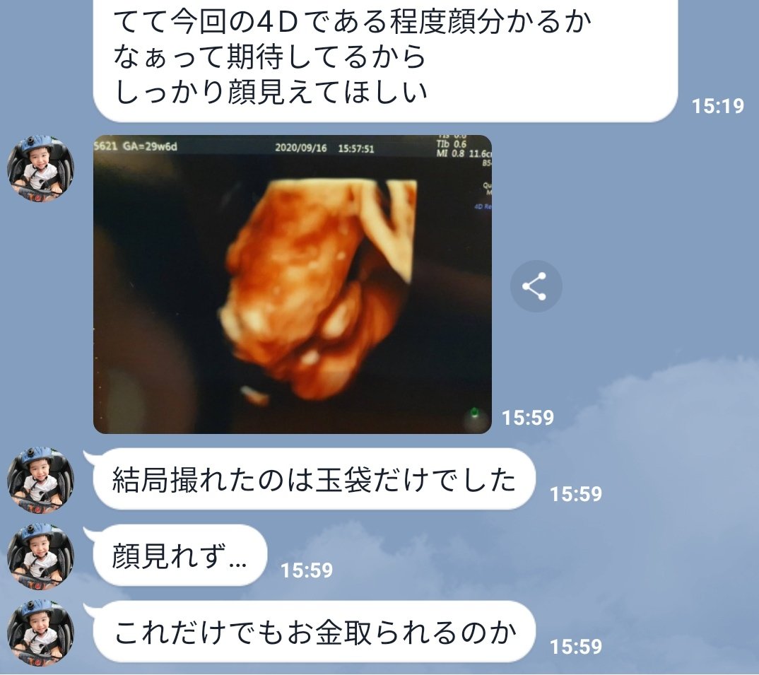 サイトー 胎児の顔まで分かる4dエコーを楽しみにしていた嫁 体勢悪くて金玉しか写らずお怒り T Co Lpclwwwyvf Twitter