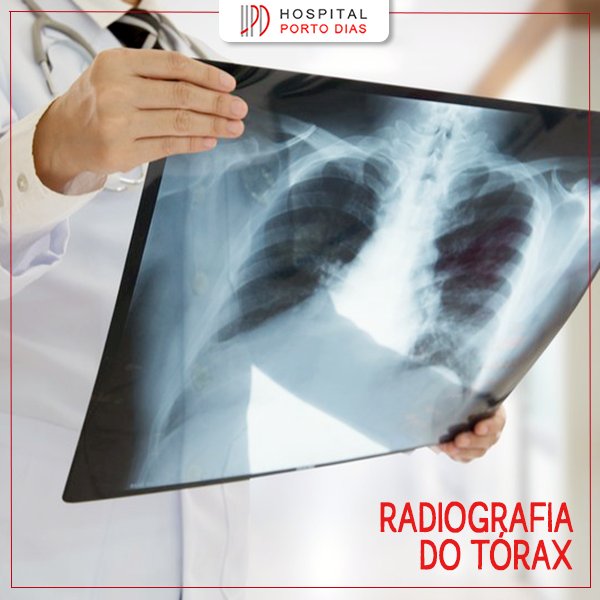 x-ray varicoza)