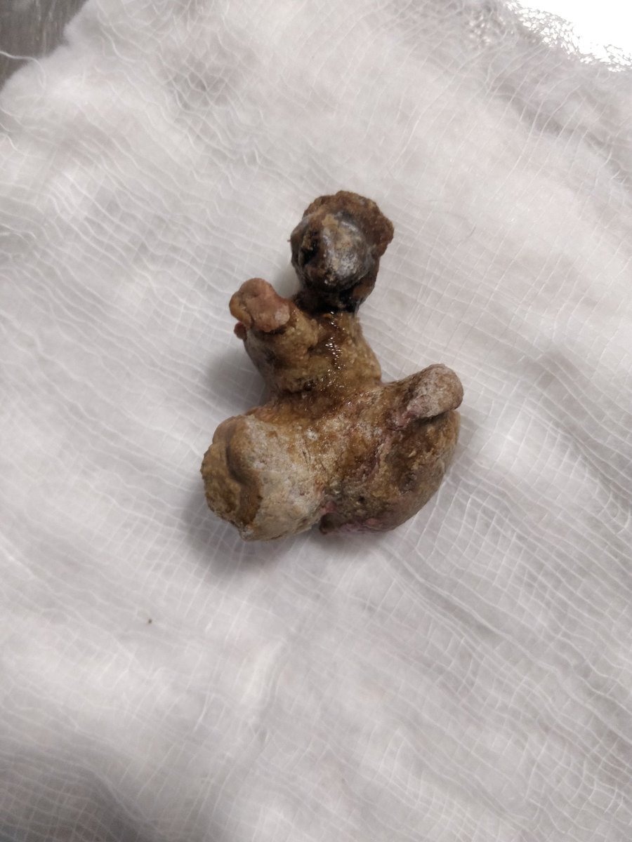 ipitoi's tweet image. 