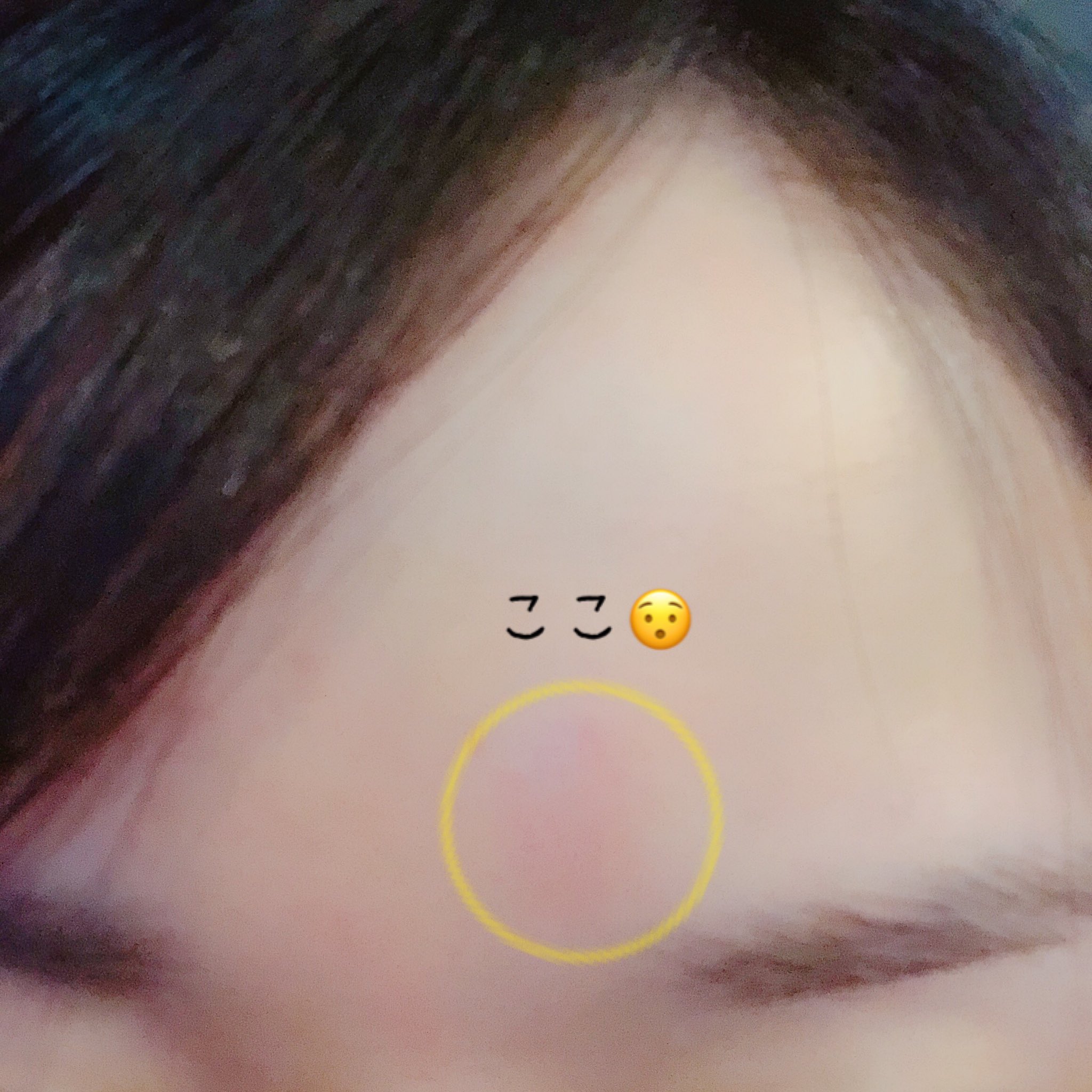 小倉唯 花粉症です おデコ蚊に刺されてた ムヒって顔に塗っていいのかしら ぴえん W 小倉唯 花粉症です おデコ蚊に刺されてた ムヒって顔に塗っていいのかしら ぴえん W