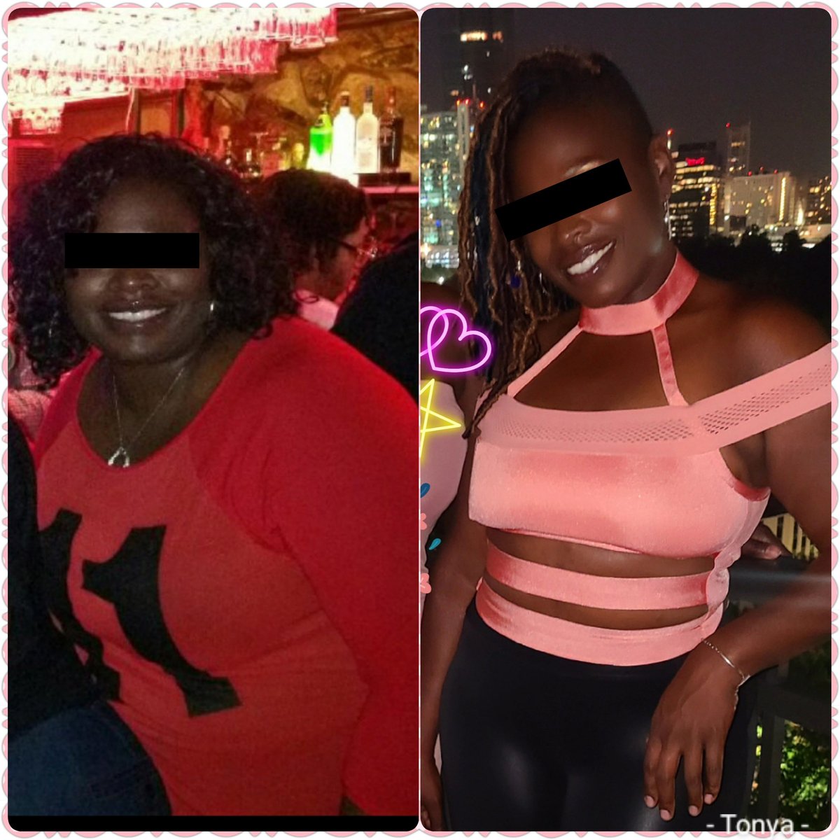 DrKotis's tweet photo. Patient fully dressed before and after. We completed "360 Lipo" and a full #TummyTuck. Great example provided by the patient directly.  #realresults
.
.
.
.
.
#abdominoplasty #plasticsurgery  #liposuction #cosmeticsurgery #plasticsurgeon #breastlift #mommymakeover #beauty https://t.co/vuq00gh4Qo