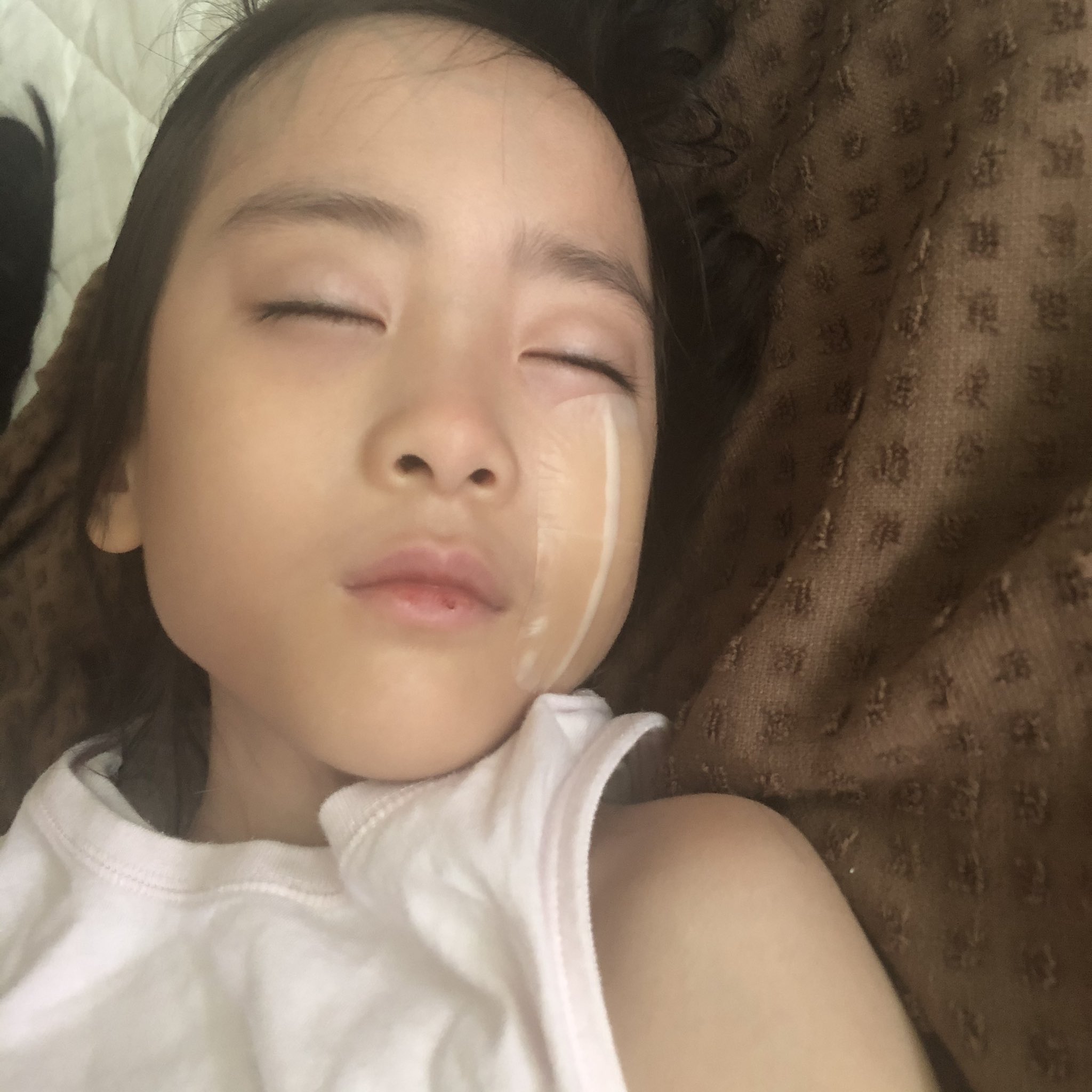 かねかよ かわいいだけが取り柄のジージョの顔に傷がついた 女の子なのに 猫のひっかき傷ってどれくらい治るんだろう 皮膚科整形外科早めに受診した方が良いよね 育児 猫 アスクドクターズ T Co Fvmxls1ke8 Twitter