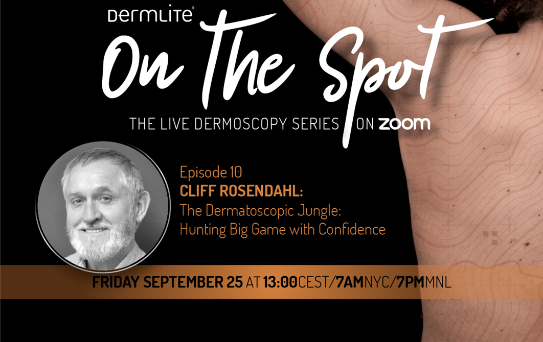 DermLite's On the Spot Live Dermoscopy series this week feature's Australia's Cliff Rosendahl. Starting at 9pm Friday Sept 25 - Register now! 
us02web.zoom.us/webinar/regist…