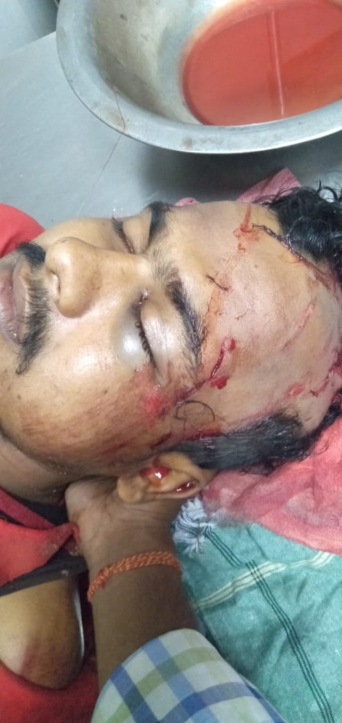 AENFOdisha's tweet photo. Chitta Ranjan Sahu from Kaima, Dharmasala Block, Jaipur faced one severe accident. His Spinal cord,one leg
 &amp; Chest rib are broken got Internal head injury,one eye also affected. A very Financial weak boy.
Sir Please help him 🙏🏻 
@JajpurAdmn
@sabyaactor https://t.co/tH9eLUkhPm