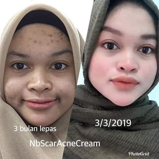 Nbcreammalaysia Instagram Posts Gramho Com
