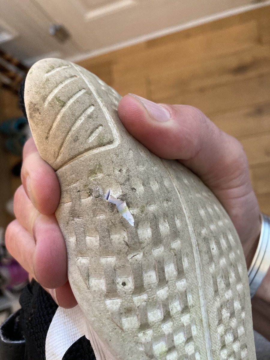 Ellie was recently running around near her school, when she trod on some broken glass that some kind soul had smashed on the ground. The glass not only cut through her shoe, but stuck itself in Ellie's foot.