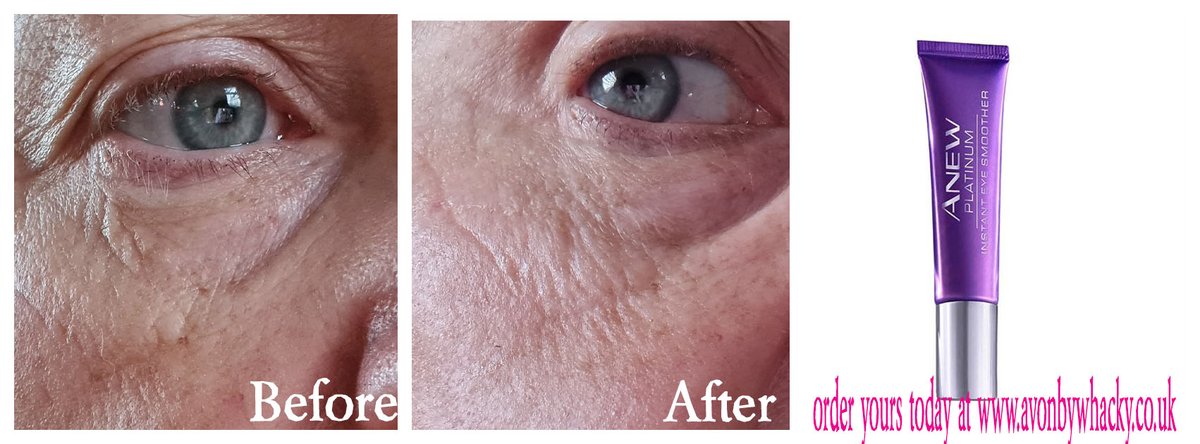 Tried the #avon #anew #instanteye #smoother this morning, yes those are my #wrinkles and wow, it works? bit.ly/2G1YzA0