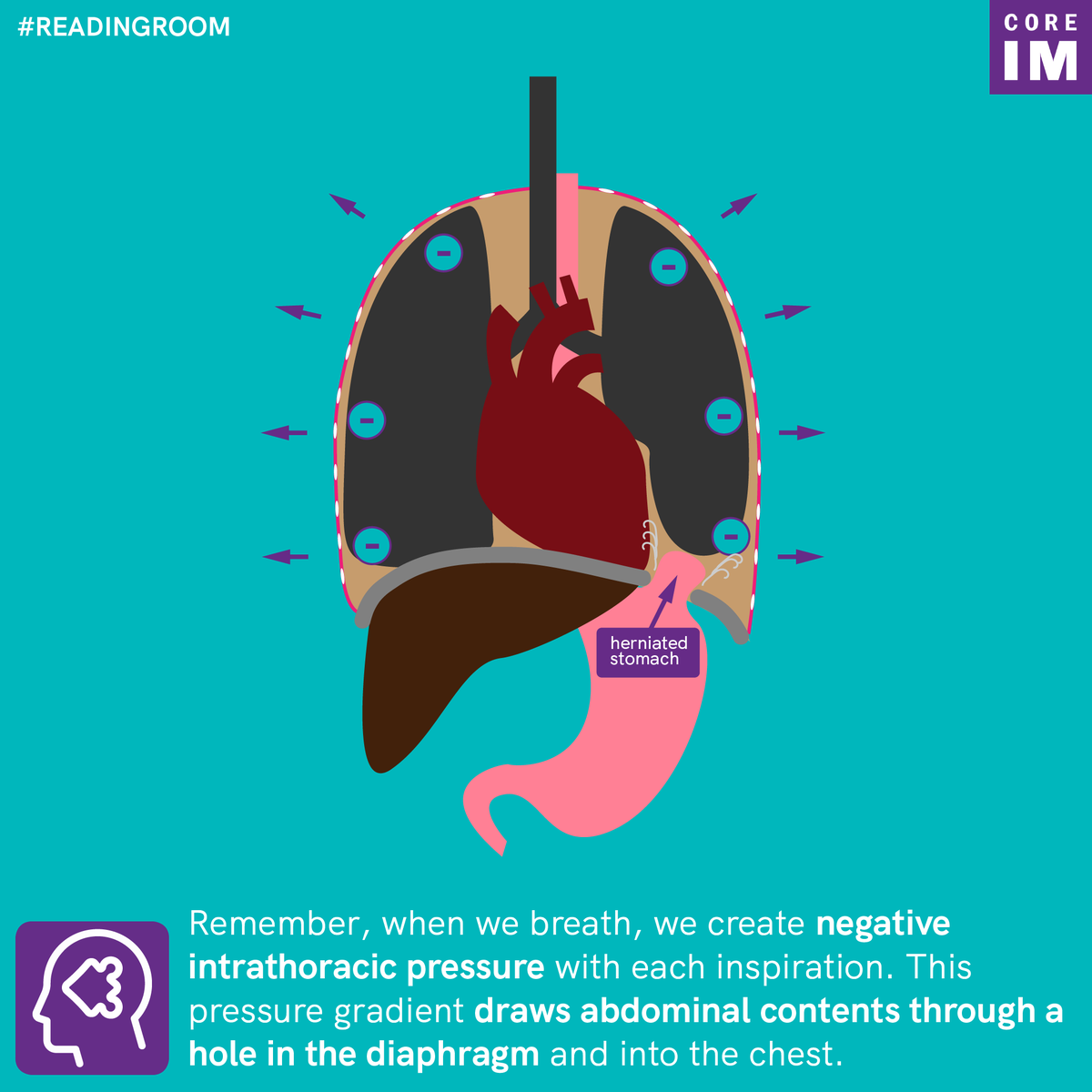 5/  #Pathophysiology nugget:Why don’t abdominal contents just stay in their compartment?!