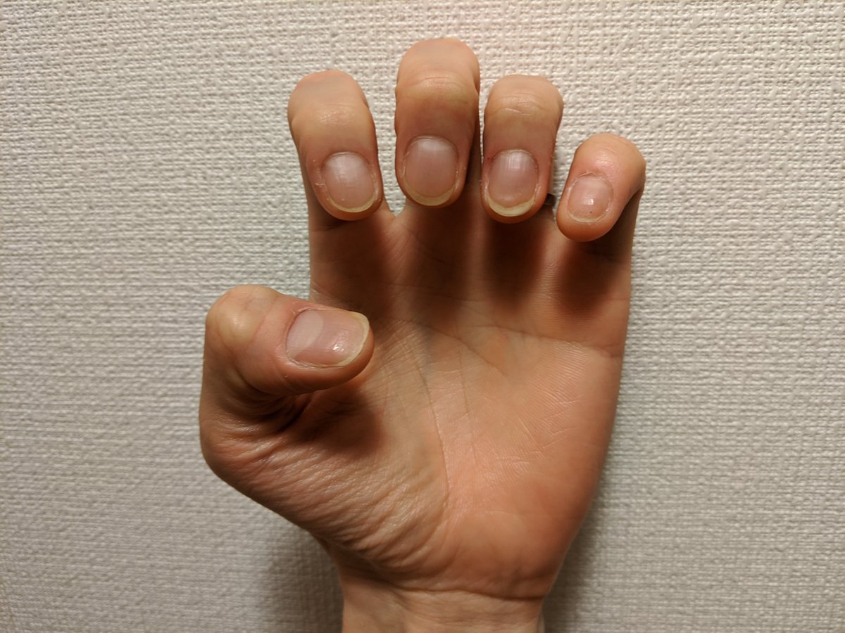 爪噛み男 Nail Biter Flat95 Twitter
