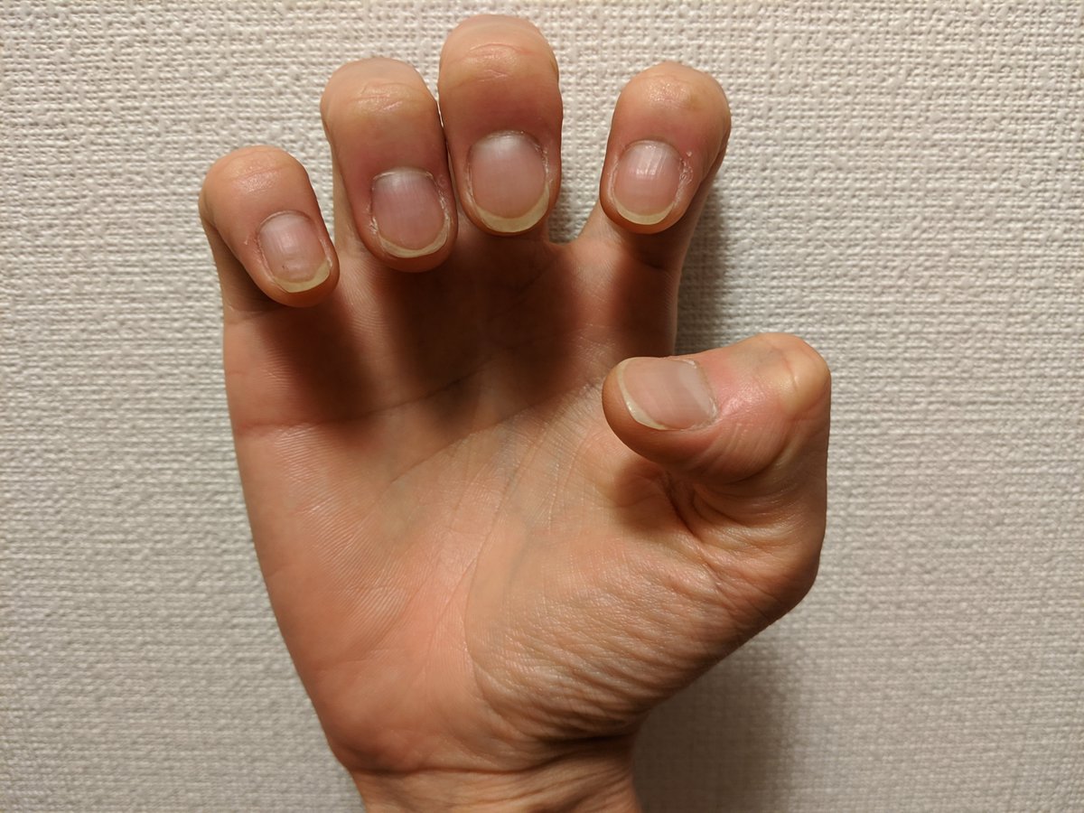爪噛み男 Nail Biter Flat95 Twitter